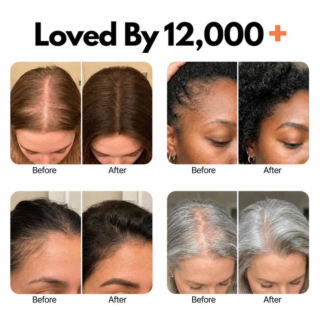 Korean Scalp Activation Serum