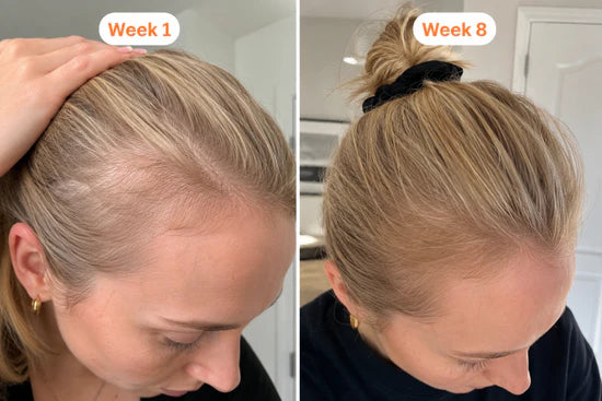 Week 1