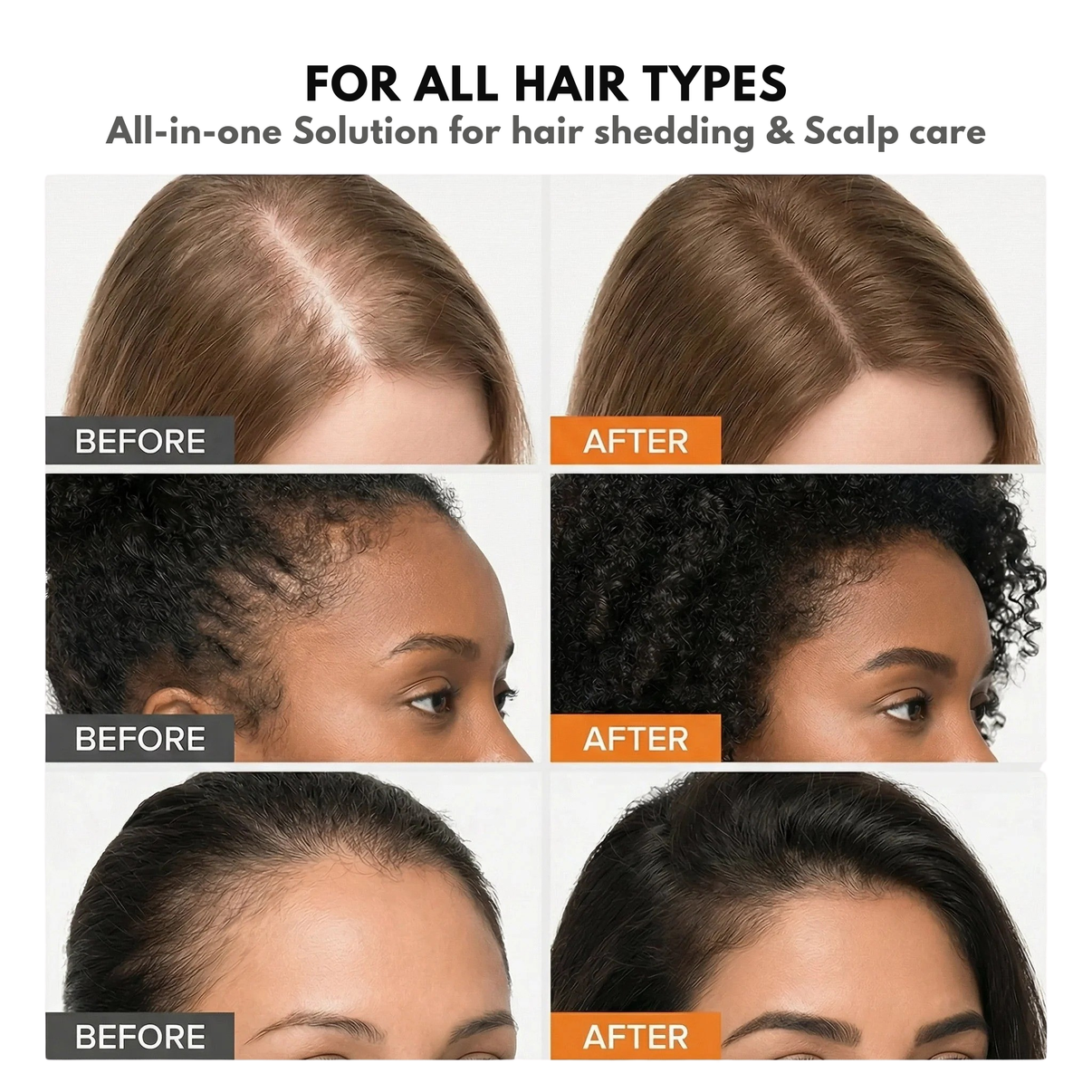 Korean Scalp Activation Serum